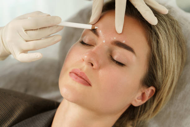 Botox - Raw Beauty Lounge Gilbert Botox - Raw Beauty Lounge Gilbert